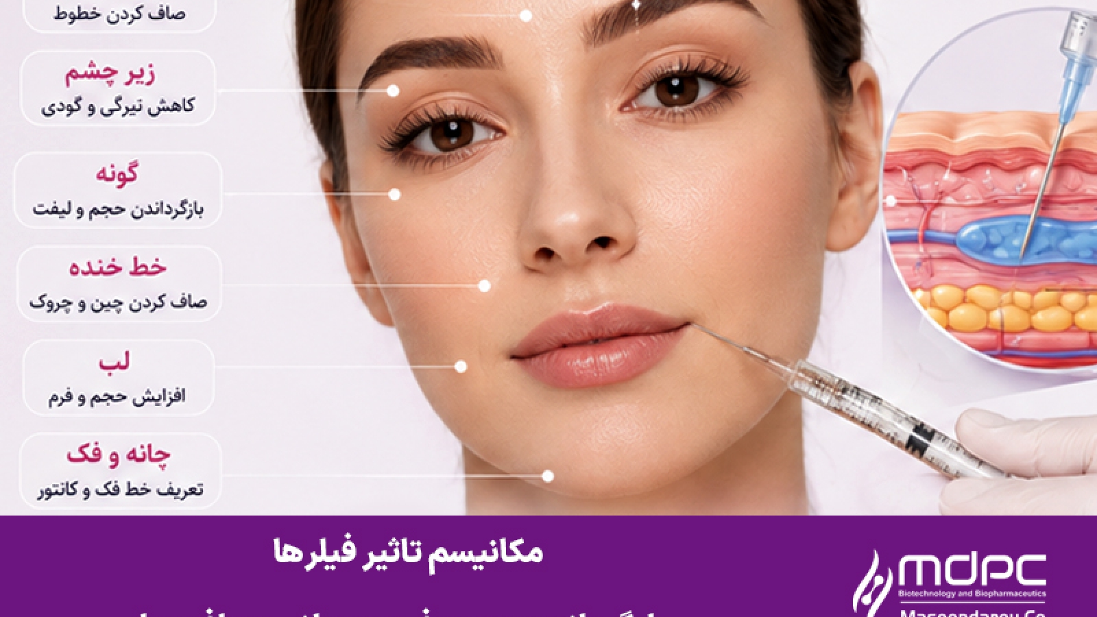 مکانیسم تاثیر فیلرها - فیلر استارفیل