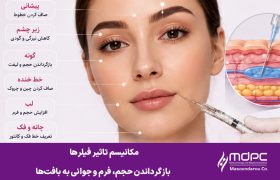 مکانیسم تاثیر فیلرها - فیلر استارفیل